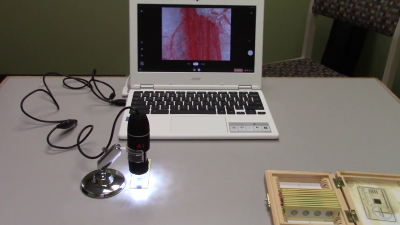 Image of USB Microscope and slide connected to a Chromebook displaying image of from microscope.